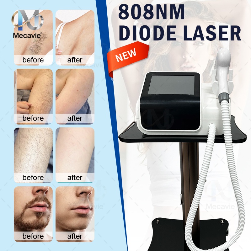 Industrial Laser Hair Removal Machine - جهاز إزالة الشعر بالديود الجديد لعام